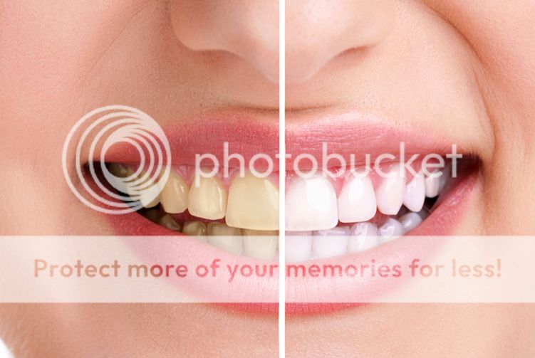 Does Green Tea Stain Your Teeth TeethWalls